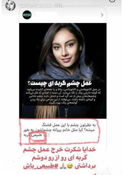 چشم گربه ای ترلان پروانه