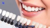 ویتامین‌های معجزه‌گر برای داشتن دندان‌هایی سفید و سالم