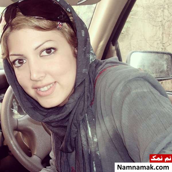سالومه سیدنیا قبل از عمل