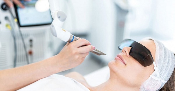 لیزر موهای زائد چیست؟