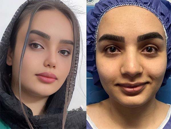 بهترین جراح بینی نیمه فانتزی کیست؟ +لیست 10تایی