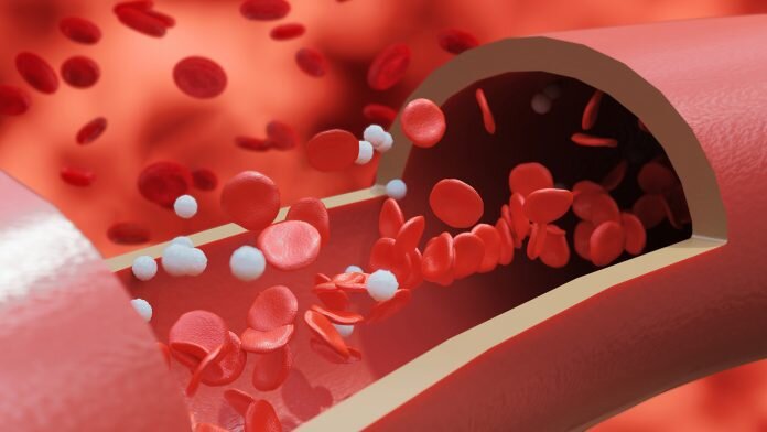 ریزپلاستیک‌ها متهم بروز بیماری‌های عروقی هم شدند