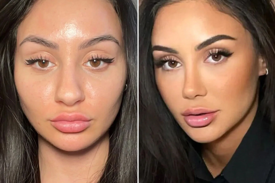 بینی نیمه فانتزی گوشتی