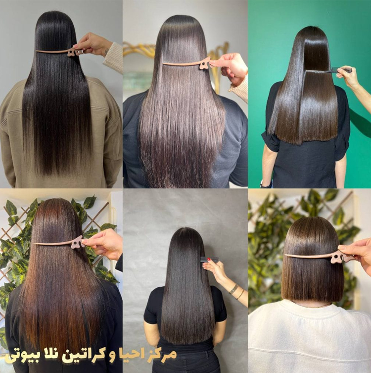 سالن کراتین و احیا نلا - محدوده شمال تهران