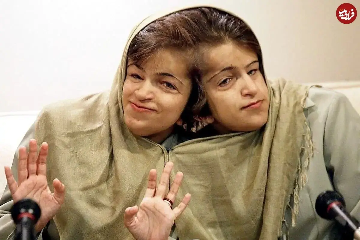 سفر شگفت‌انگیز به دهه ۵۰ با عکس‌های ناب «لاله و لادن» دوقلوهای به هم چسبیده