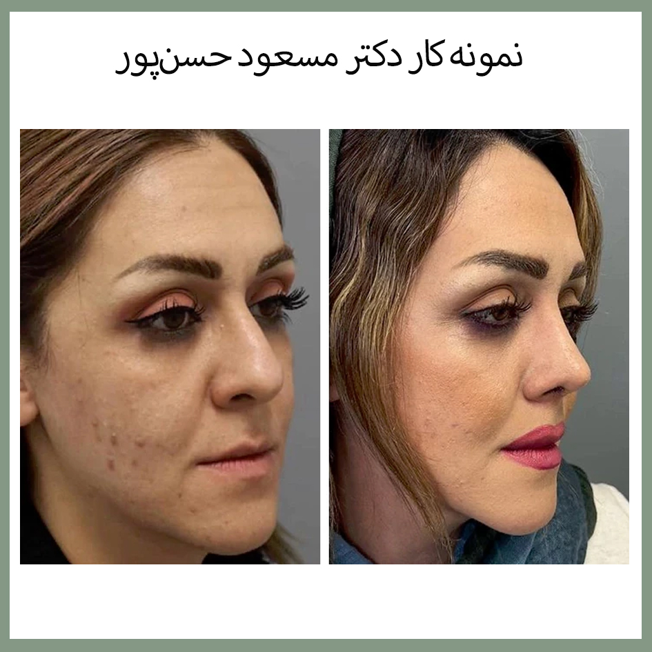 نمونه کار دکتر مسعود حسن پور