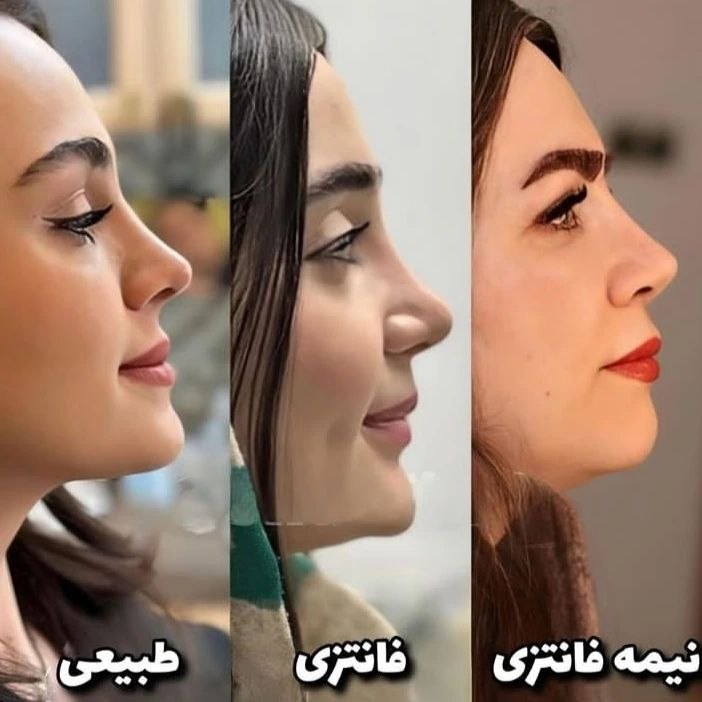  بینی نیمه فانتزی نوک تیز