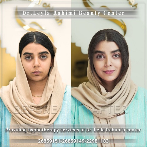 هایفو چگونه انجام میشود؟