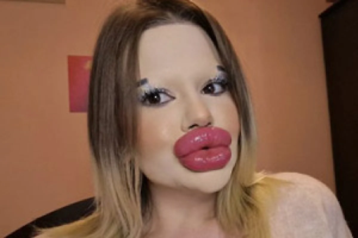 زن جوانی با بزرگ‌ترین لب‌ها و استخوان گونه‌های جهان که همه را حیرت‌زده کرد!