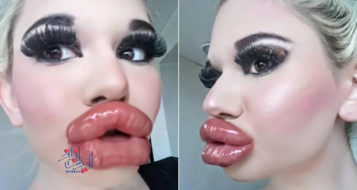 169790289852103-irannaz-com آندره آ ایوانووا - Andrea Ivanova دارای بزرگترین لب و استخوان گونه