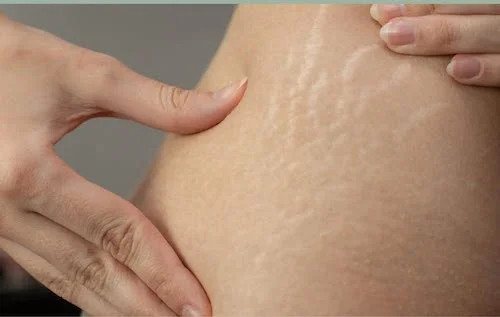 ترند زیبایی طبیعی