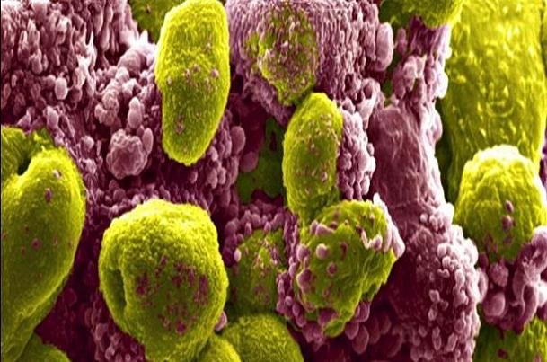 کشف دارویی که مرگ ناشی از سرطان پروستات را بیش از ۴۰٪ کاهش می‌دهد!