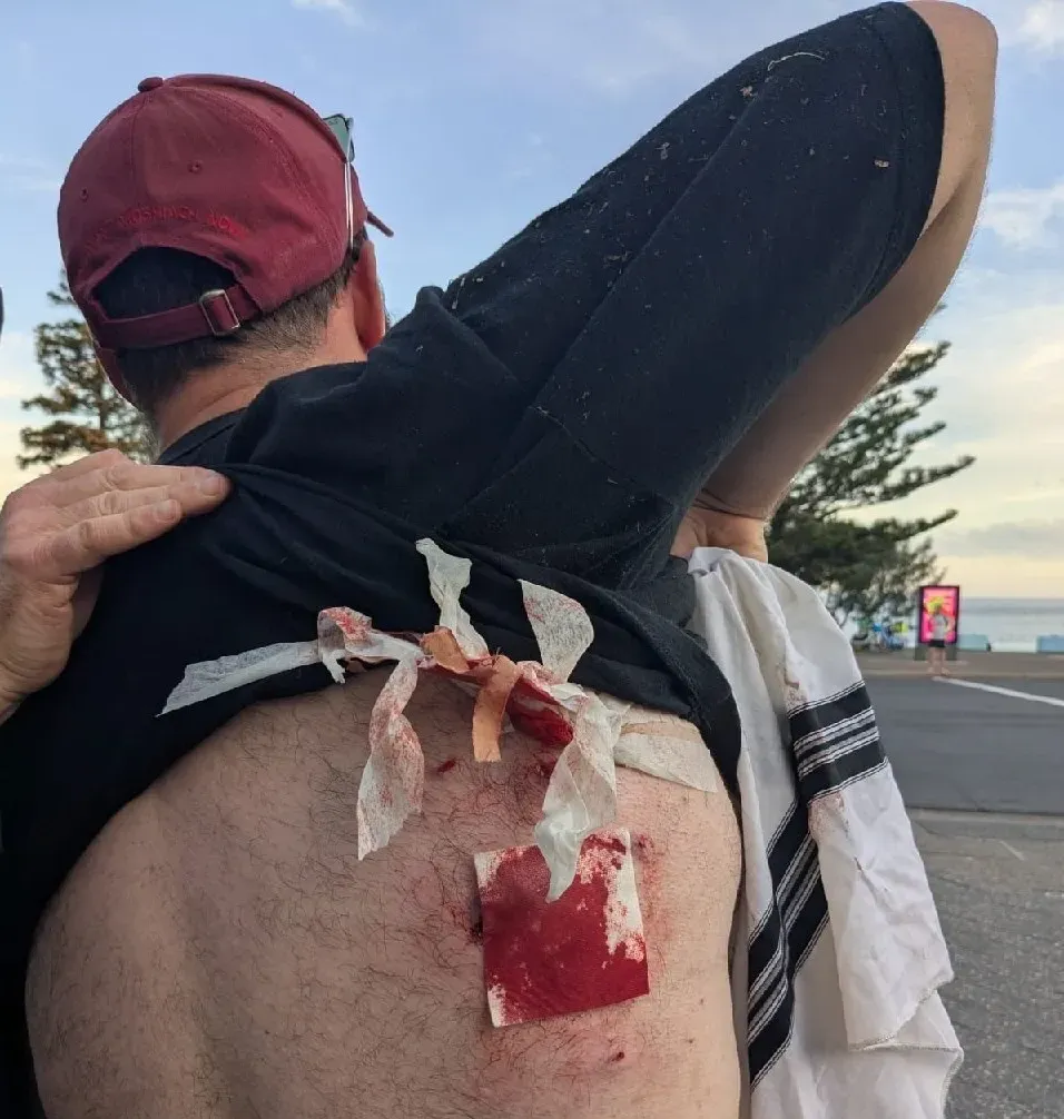 یکی از مجروحان تیراندازی یکی از مجروحان تیراندازی