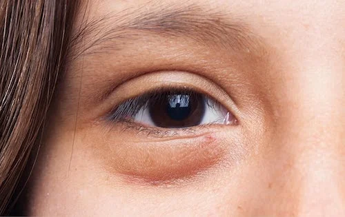 ترند زیبایی طبیعی