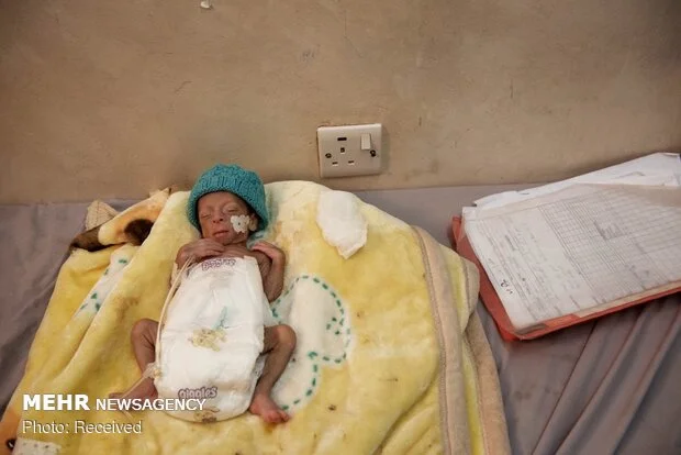 شیوع مرگبار وبا در جنوب غربی پاکستان؛ ۸ قربانی جدید در ۳ هفته گذشته