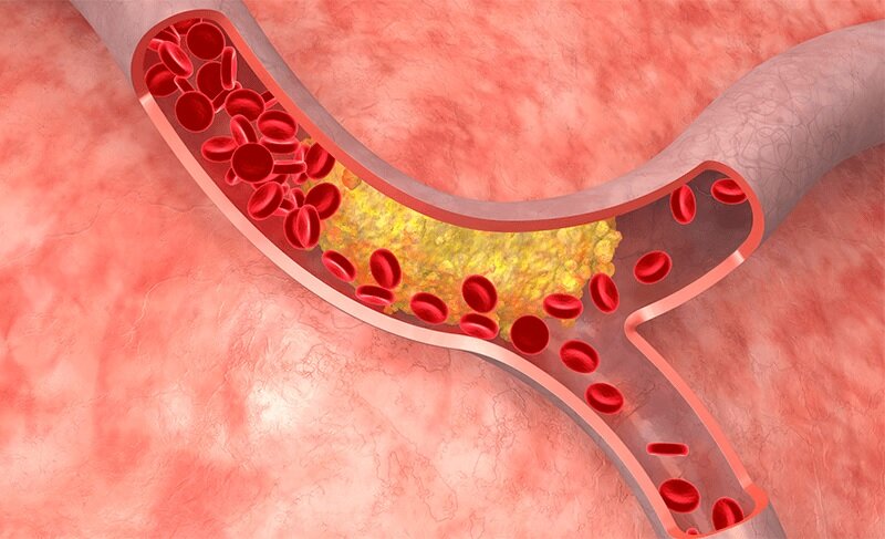 چای سبز؛ راز ساده و طبیعی کاهش چربی خون که همه باید بدانند!