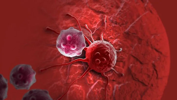 افزایش نگران‌کننده سرطان پستان در زنان ایرانی؛ چرا غربالگری زودهنگام حیاتی است؟