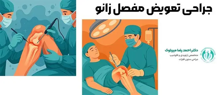 عمل تعویض مفصل زانو توسط دکتر احمدرضا میربلوک