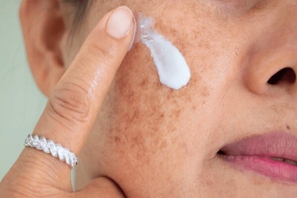 آلودگی هوا چگونه پوست شما را به سمت التهاب و سرطان می‌کشاند؟ نکات طلایی مراقبت از پوست در هوای آلوده