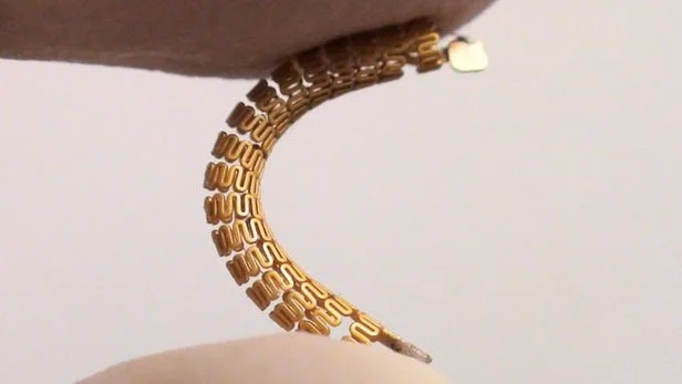 چگونه استنت‌های بهینه، خطر عوارض کلینیکی را به طرز چشمگیری کاهش می‌دهند؟