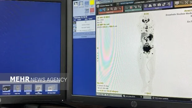 افزایش امید بیماران سرطانی به درمان؛ شکوفایی پزشکی هسته‌ای در بوشهر