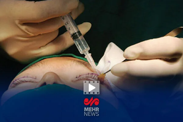 شاکی پرونده پزشک قلابی: به پزشک قانونی مراجعه کردم گفتند درست نمی‌شود