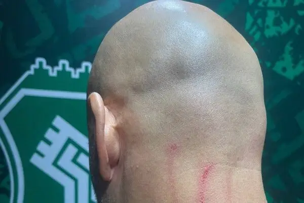 حمله عجیب به مربی استقلال؛ جراحت در پایان دیدار جنجالی با خیبر!