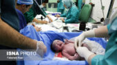 متخصص زنان هشدار داد: سزارین فقط در شرایط خاص؛ چرا زایمان طبیعی همیشه بهترین نیست؟
