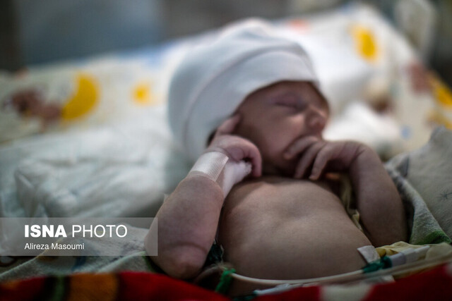 ناکامی هشداردهنده: ناهنجاری‌های بدو تولد عامل اصلی مرگ دلخراش کودکان زیر ۵ سال در یزد!