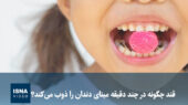 شگفتی قند در نابودی مینای دندان؛ تنها در چند دقیقه!