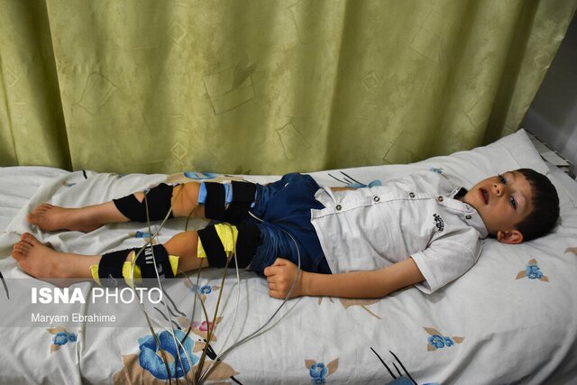 ۲۰ هزار معلول خوزستانی در انتظار دریافت حق پرستاری؛ صدای بی‌پاسخ در بهزیستی!