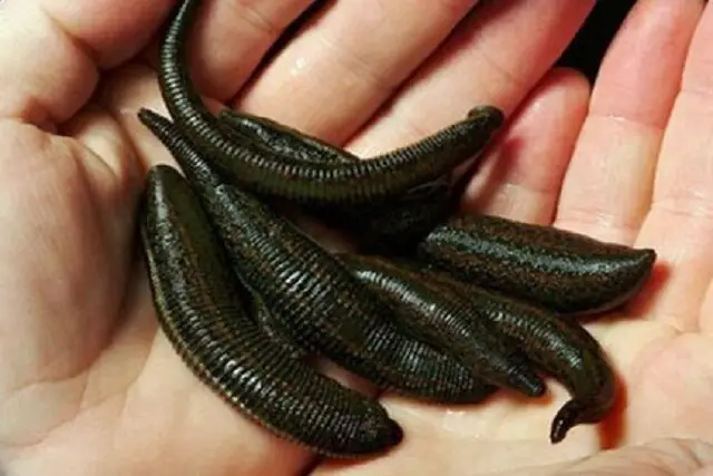 زالو درمانی؛ راهی نوین و موثر برای مقابله با پسوریازیس؟