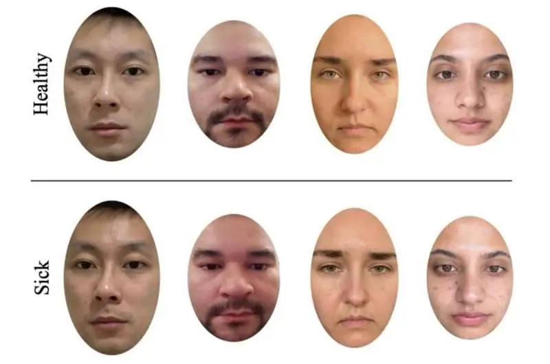 زنان در تشخیص بیماری از روی چهره، بهتر از مردان هستند