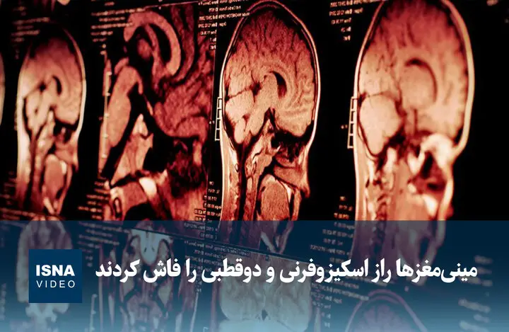 راز شگفت‌انگیز اسکیزوفرنی و دوقطبی در مینی‌مغزهای ساخته‌شده فاش شد!