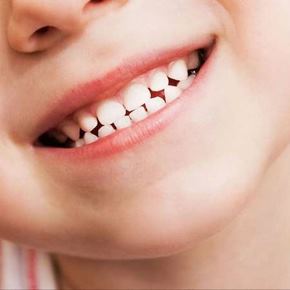 چقدر طول می‌کشد تا دندان دائمی بعد از افتادن دندان شیری رشد کند؟ پاسخ به نگرانی والدین!