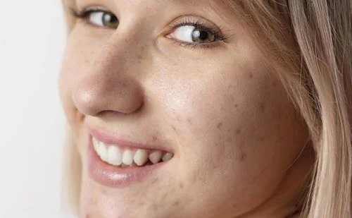 ترند زیبایی طبیعی