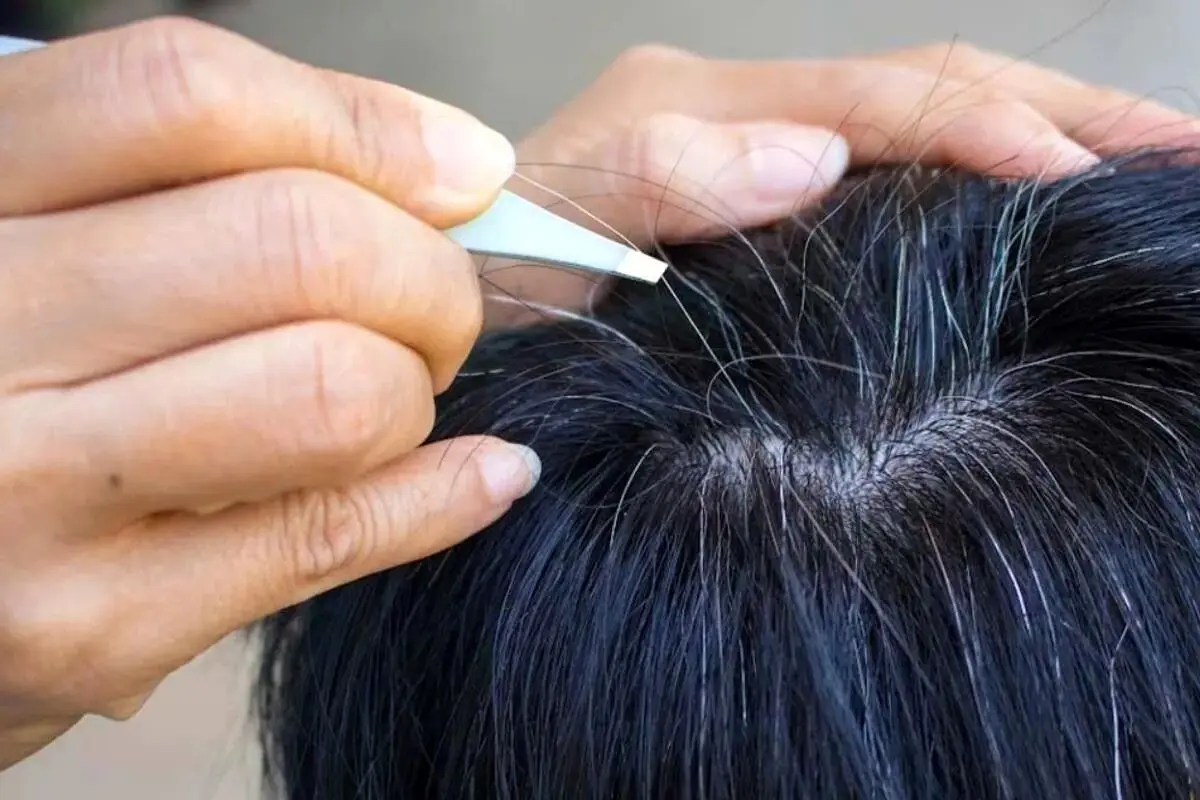 طب سنتی با چه رازهایی علت سفیدی مو را توضیح می‌دهد؟ کشف نکات شگفت‌انگیز درباره سلامت و تغذیه!
