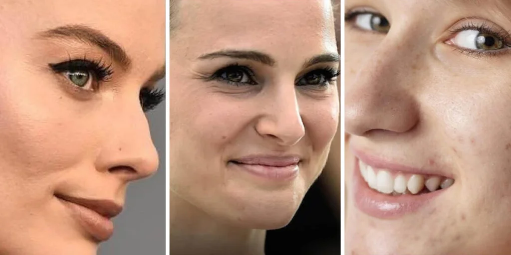 چرا پوست طبیعی و بینی قوزدار حالا مد روز شده‌اند؟ راز زیبایی واقعی فاش شد!