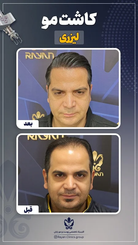 Before After Farsi L - 12