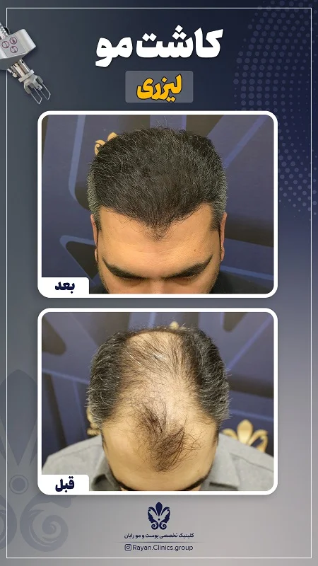 Before After Farsi L - 2