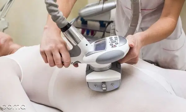 دستگاه ال پی جی (LPG)