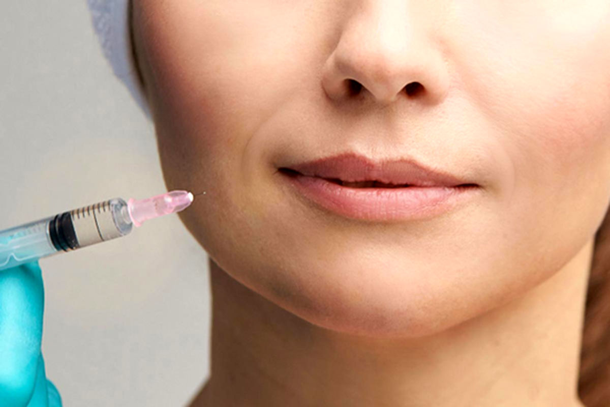 کدام پزشک در تهران بهترین تزریق چربی را انجام می‌دهد؟ راز جوانسازی پوست فاش شد!