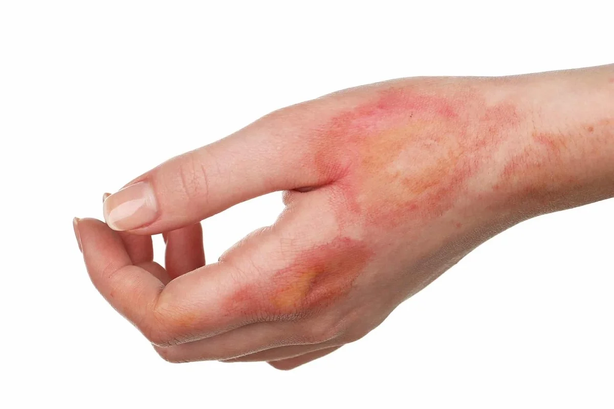 سلول های بنیادی