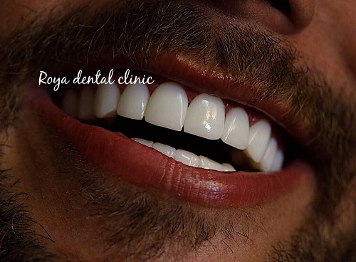 کلینیک دندانپزشکی رویا