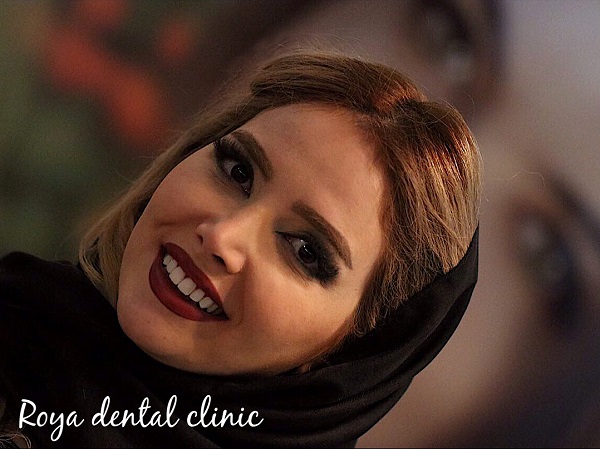 کامپوزیت دندان چیست؟