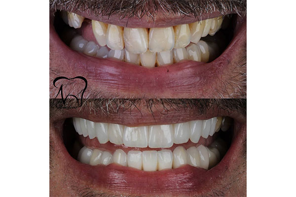 دندانپزشکی نیکا دنت