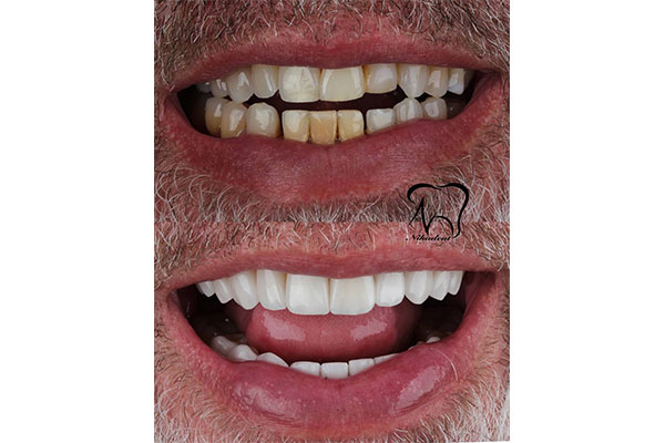 کلینیک نیکا دنت