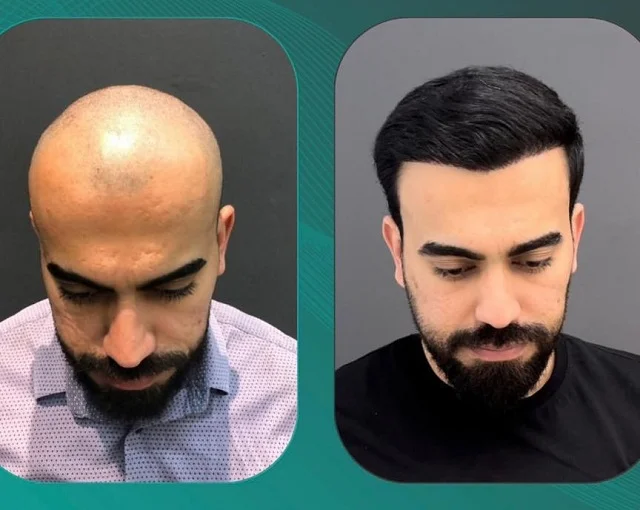 کلینیک زیبایی پارسیان بیوتی