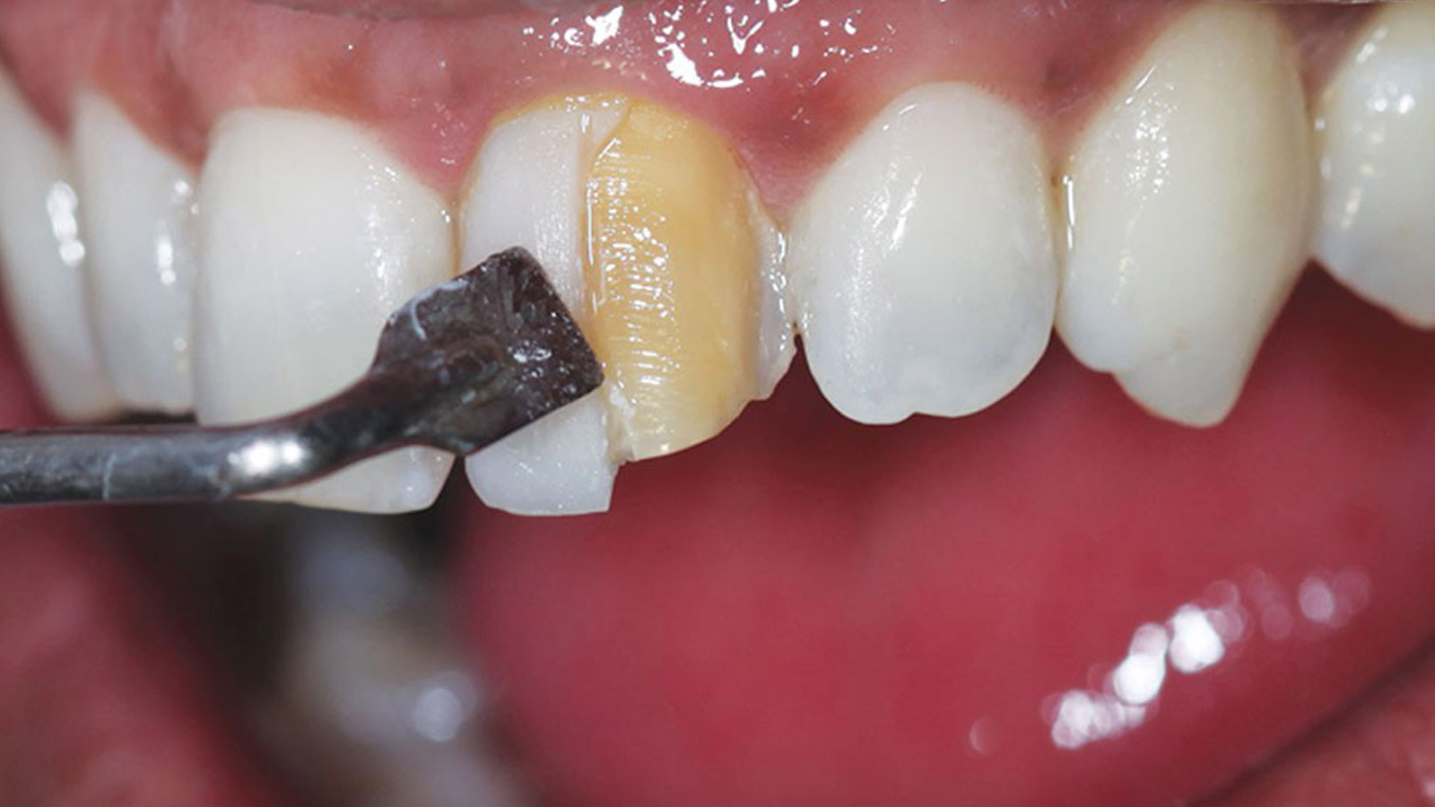 کامپوزیت اقساطی چگونه پرداخت می‌شود؟