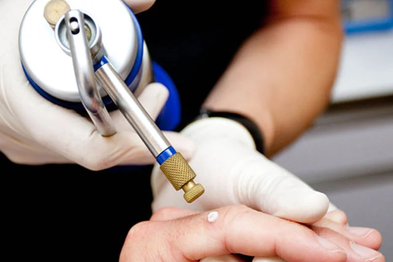 درمان فوتودینامیک (PDT)